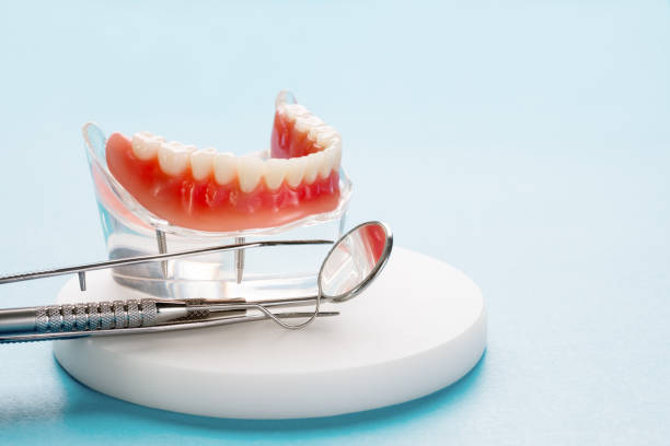 Dental Bonding in Jackson, LA